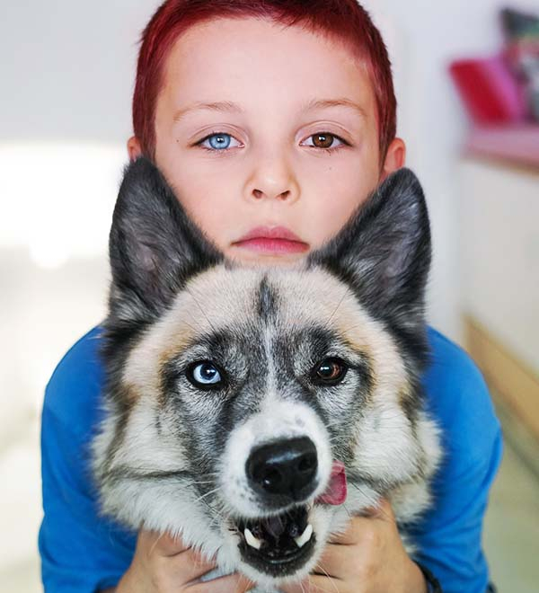 Un garçon et son chien, tous les deux atteints d’hétérochromie