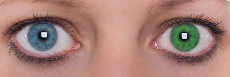 Heterochromia meaning