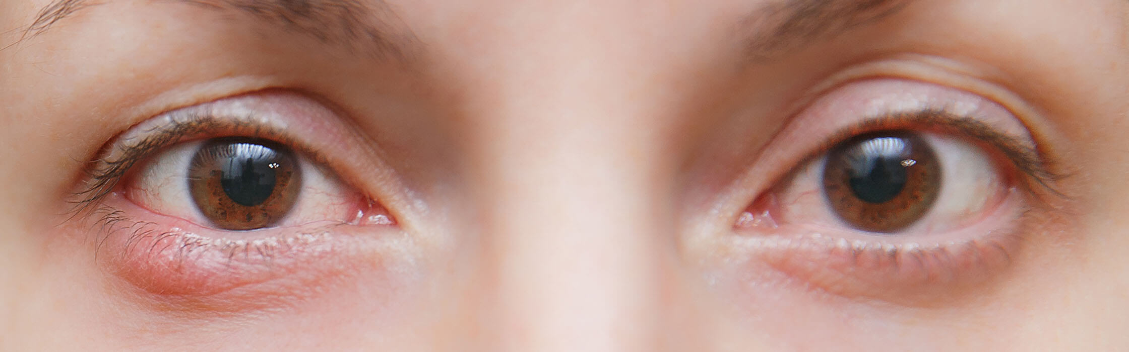 Twee bruine ogen met een strontje op het linker ooglid

        
