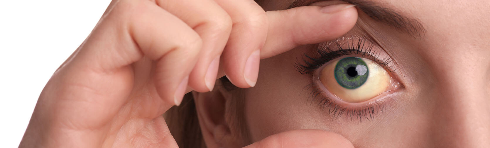 Infections des yeux et lentilles de contact
