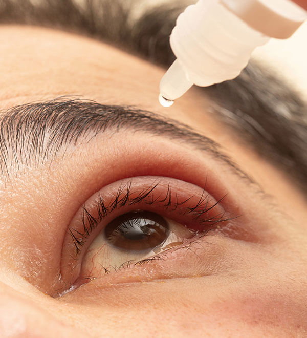 Infections des yeux et lentilles de contact