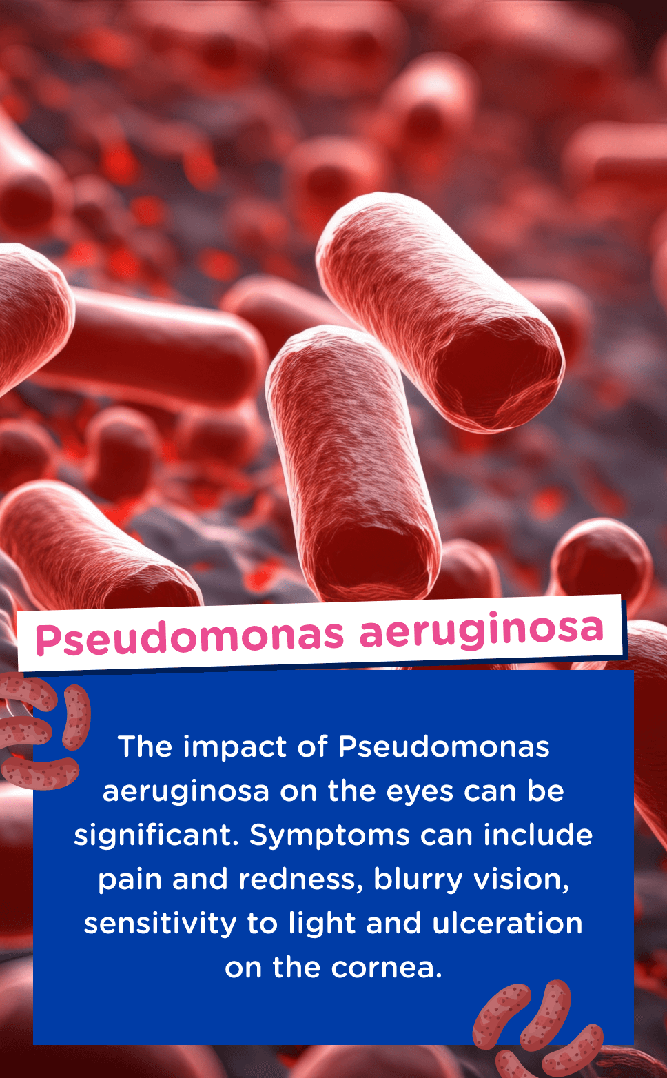 Image of Pseudomonas aeruginosa bacteria