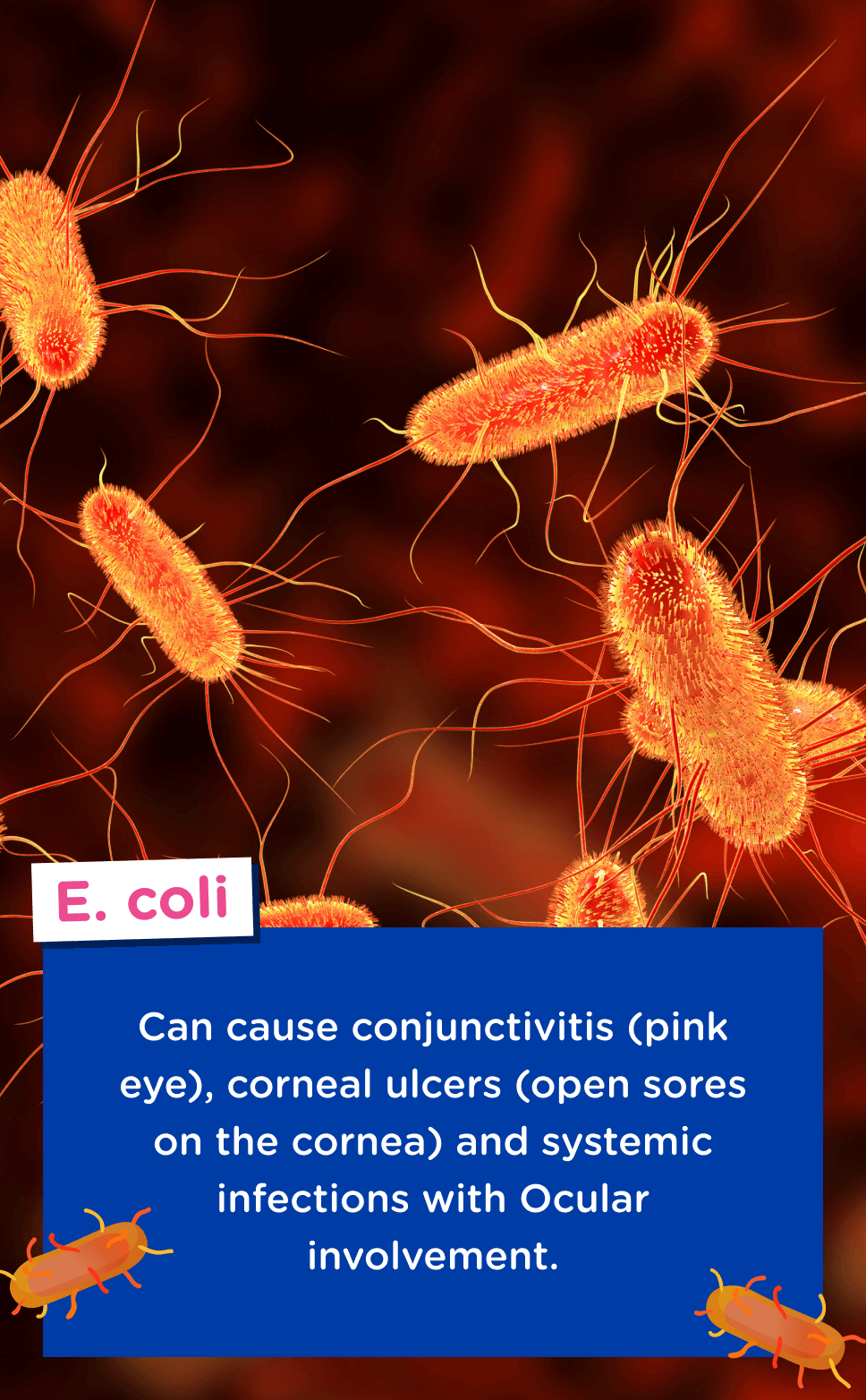 Image of E.Coli bacteria